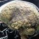 A real human brain, seen above, on display during an 2011 exhibit held at the At-Bristol Science Center in the UK. Photo: Getty